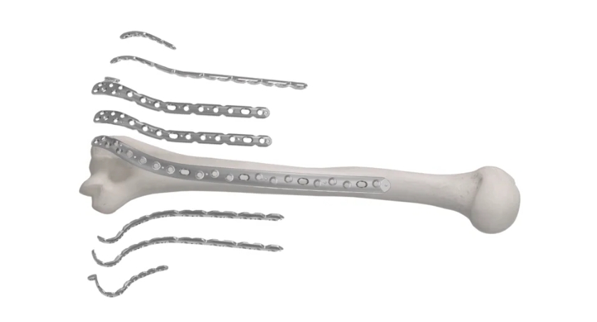 Globus Launches Anthem Elbow Fracture System